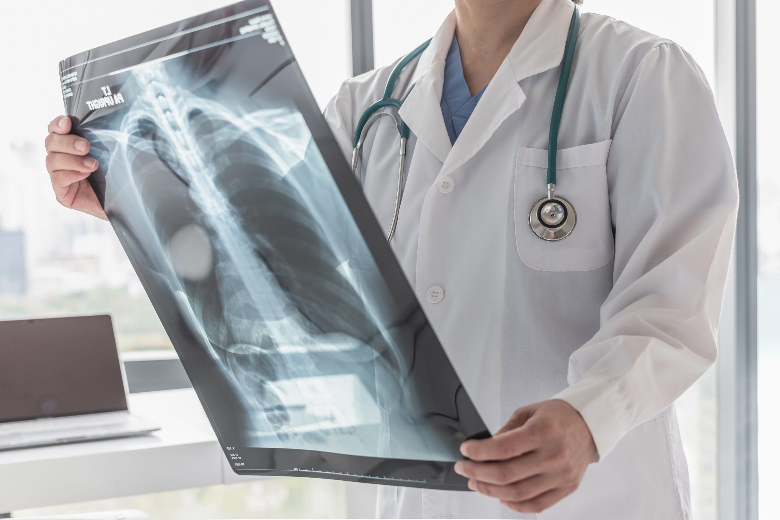How Long Does It Take Bones to Heal?